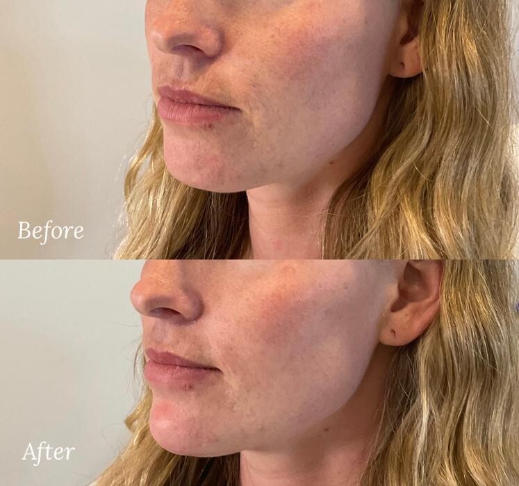 Images Subtle Aesthetics