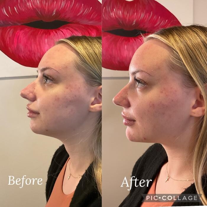 Images Subtle Aesthetics