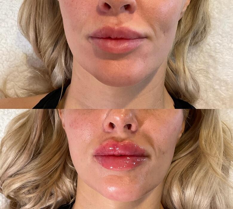 Images Subtle Aesthetics