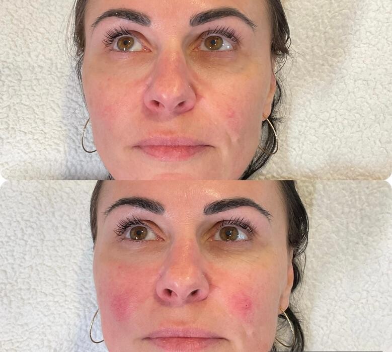 Images Subtle Aesthetics