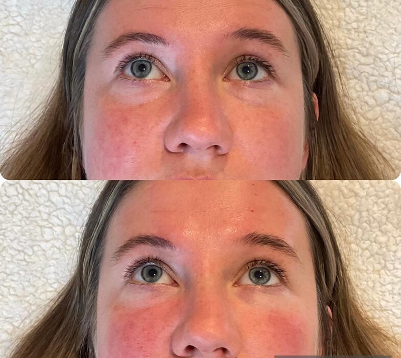 Images Subtle Aesthetics