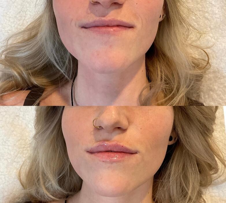 Images Subtle Aesthetics