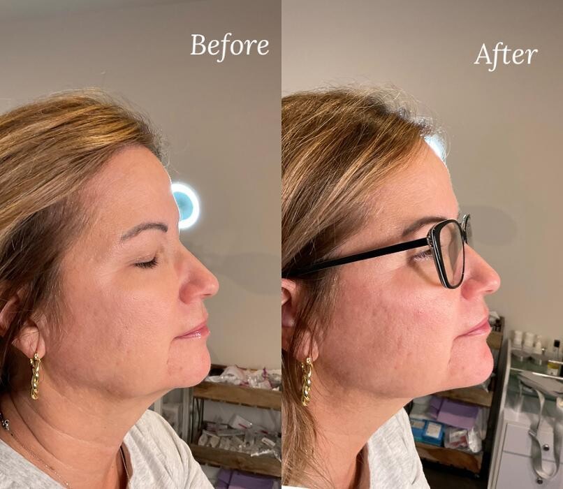 Images Subtle Aesthetics