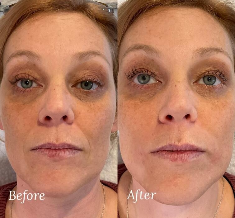 Images Subtle Aesthetics