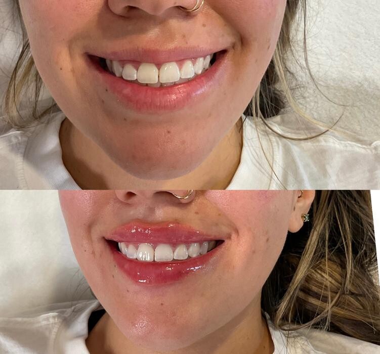 Images Subtle Aesthetics