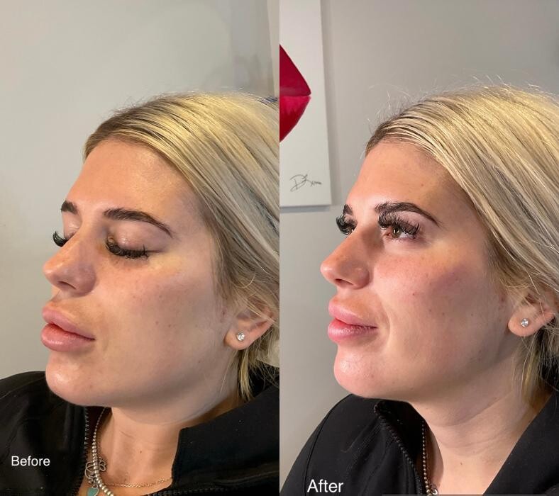 Images Subtle Aesthetics