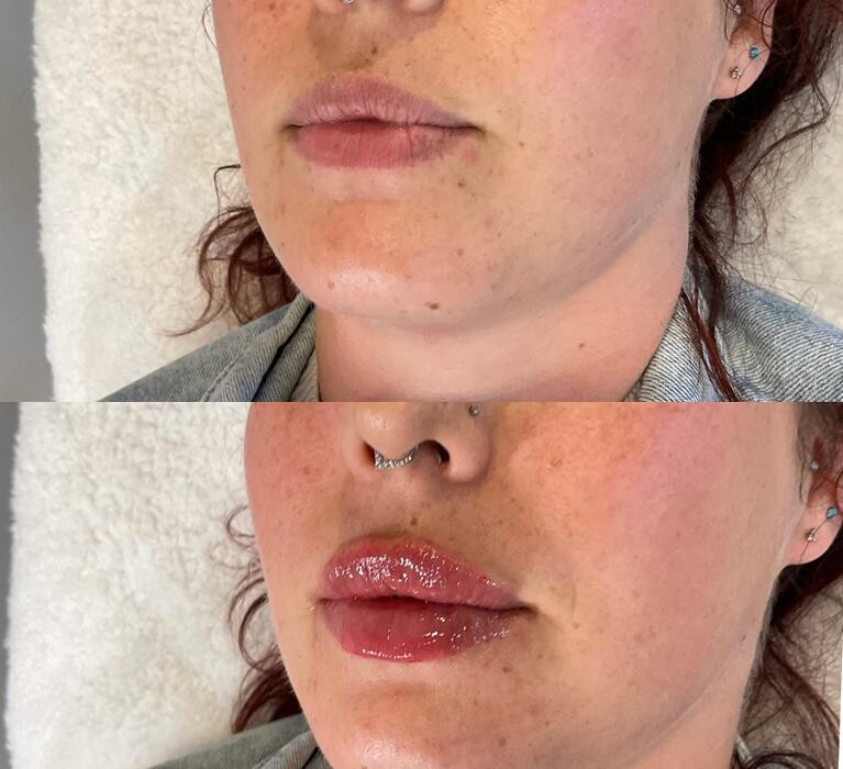 Images Subtle Aesthetics