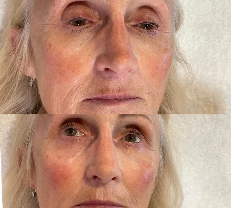 Images Subtle Aesthetics