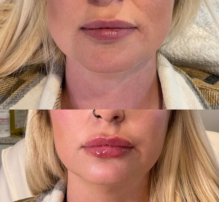 Images Subtle Aesthetics