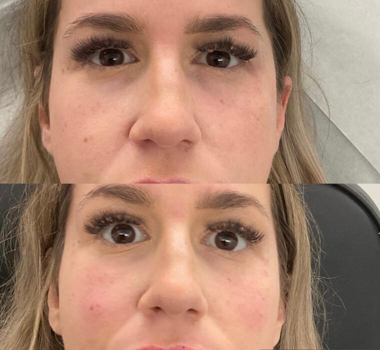 Images Subtle Aesthetics