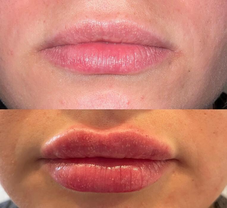 Images Subtle Aesthetics