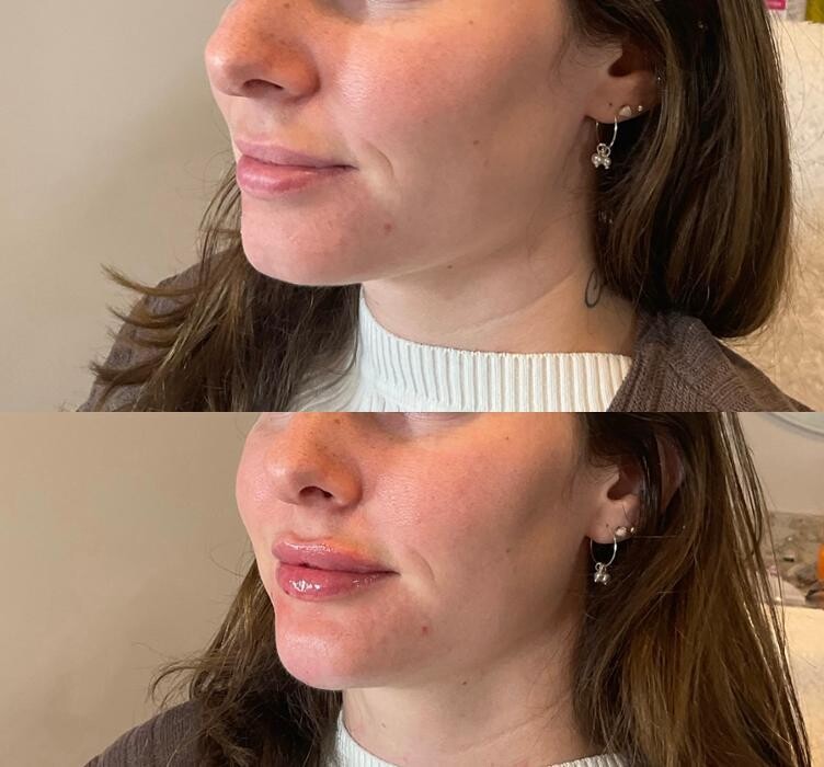 Images Subtle Aesthetics