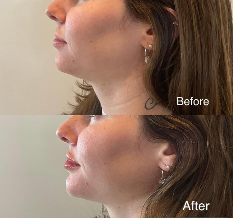 Images Subtle Aesthetics