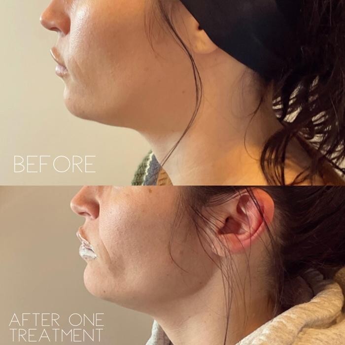 Images Subtle Aesthetics