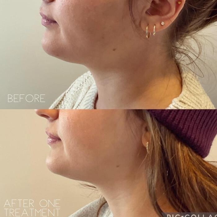 Images Subtle Aesthetics