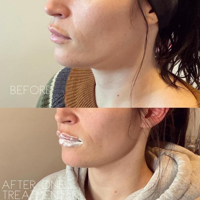 Images Subtle Aesthetics