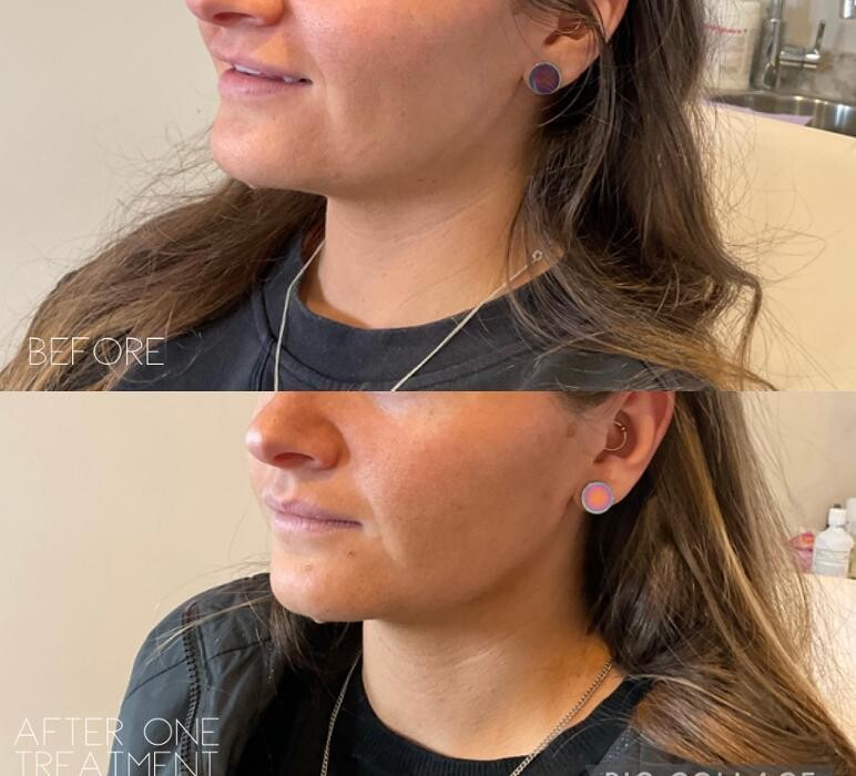 Images Subtle Aesthetics