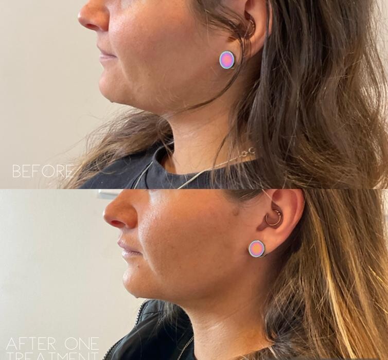 Images Subtle Aesthetics