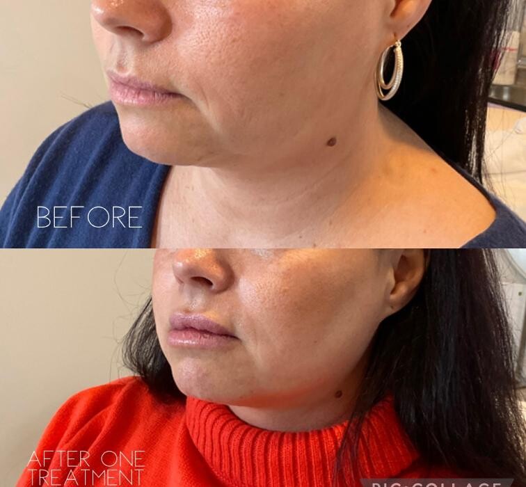 Images Subtle Aesthetics