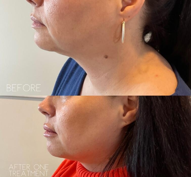 Images Subtle Aesthetics