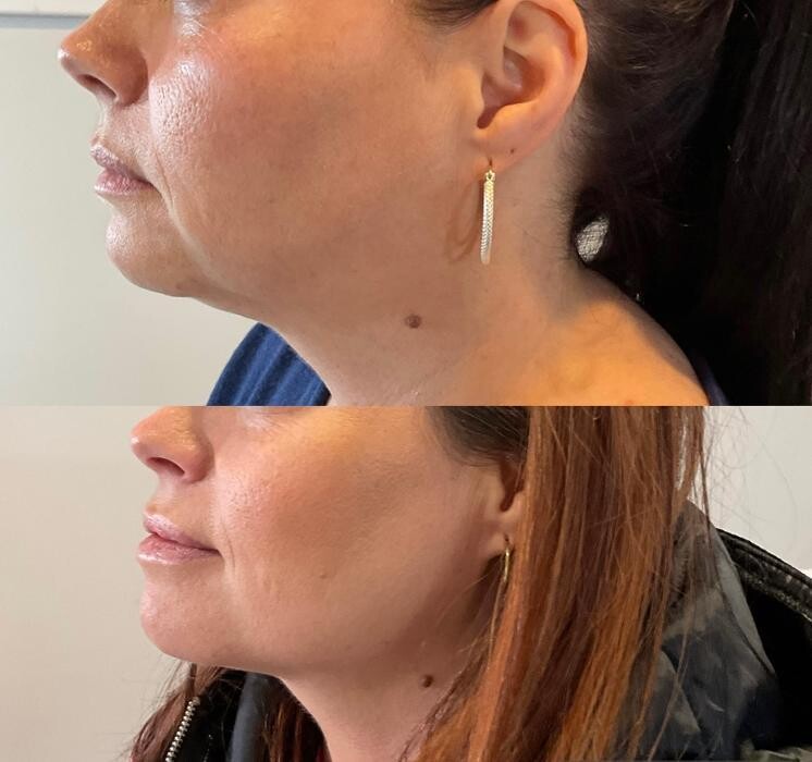 Images Subtle Aesthetics