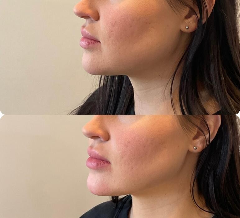 Images Subtle Aesthetics