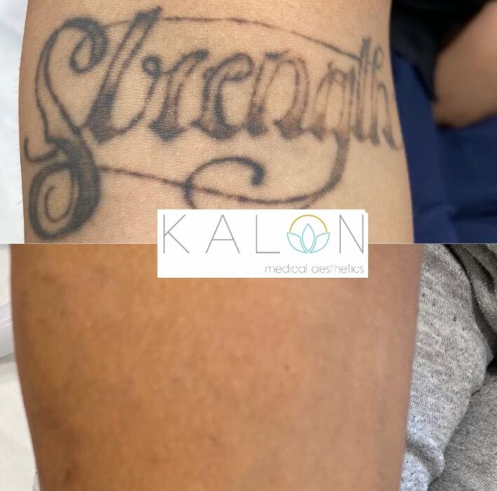 Images Kalon Medical Aesthetics