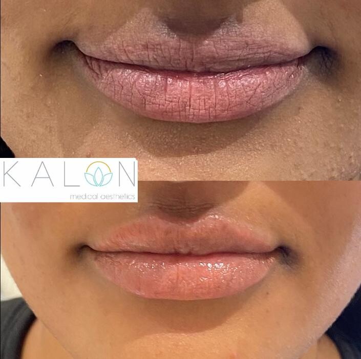 Images Kalon Medical Aesthetics