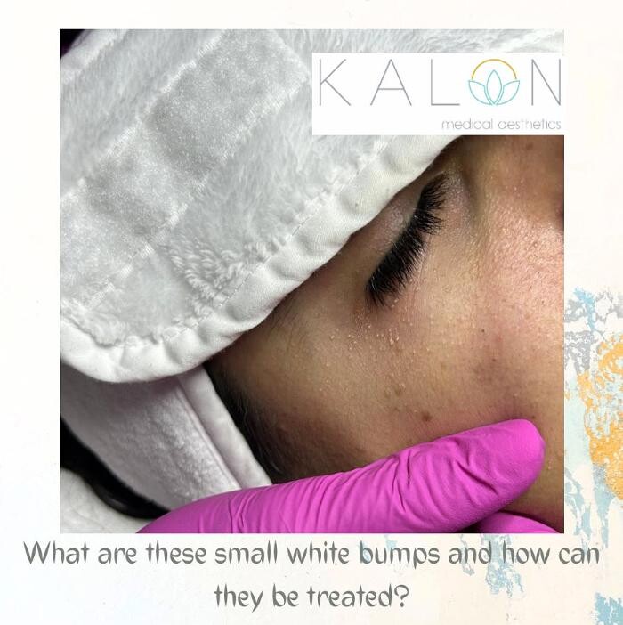 Images Kalon Medical Aesthetics