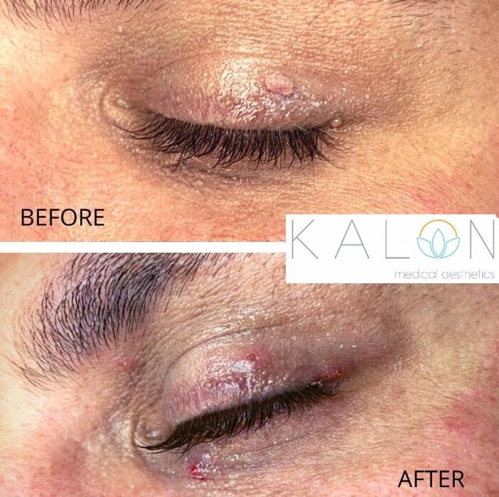 Images Kalon Medical Aesthetics