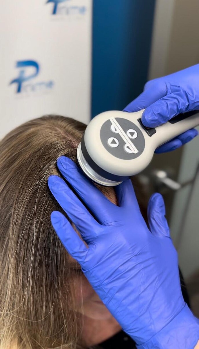 Images Prime Hair Clinic