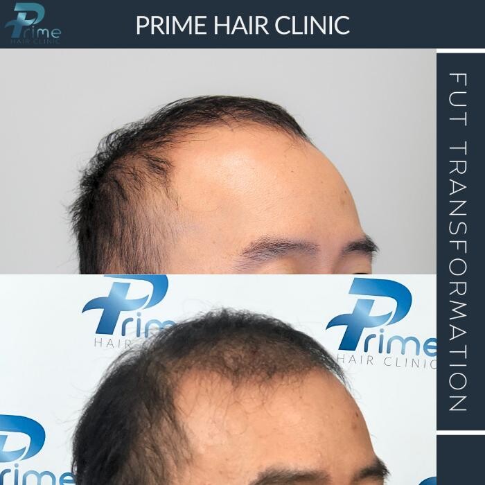 Images Prime Hair Clinic