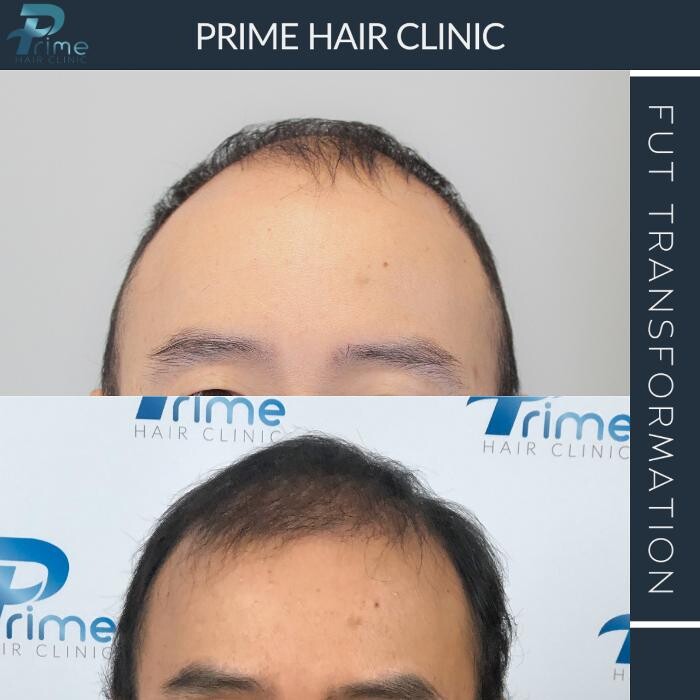 Images Prime Hair Clinic
