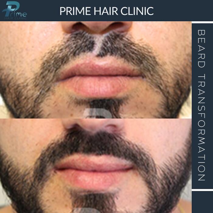 Images Prime Hair Clinic