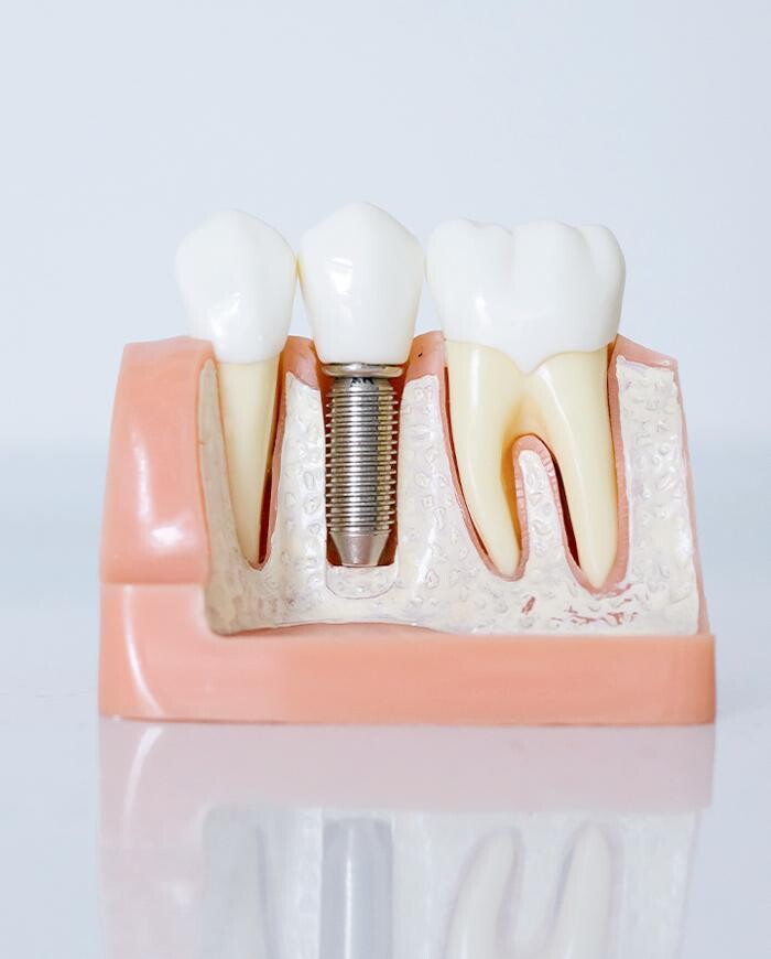 Images Star Dental