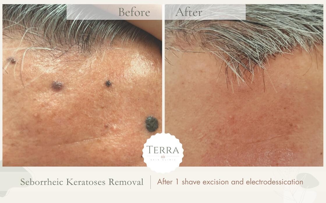 Images Terra Skin Clinic