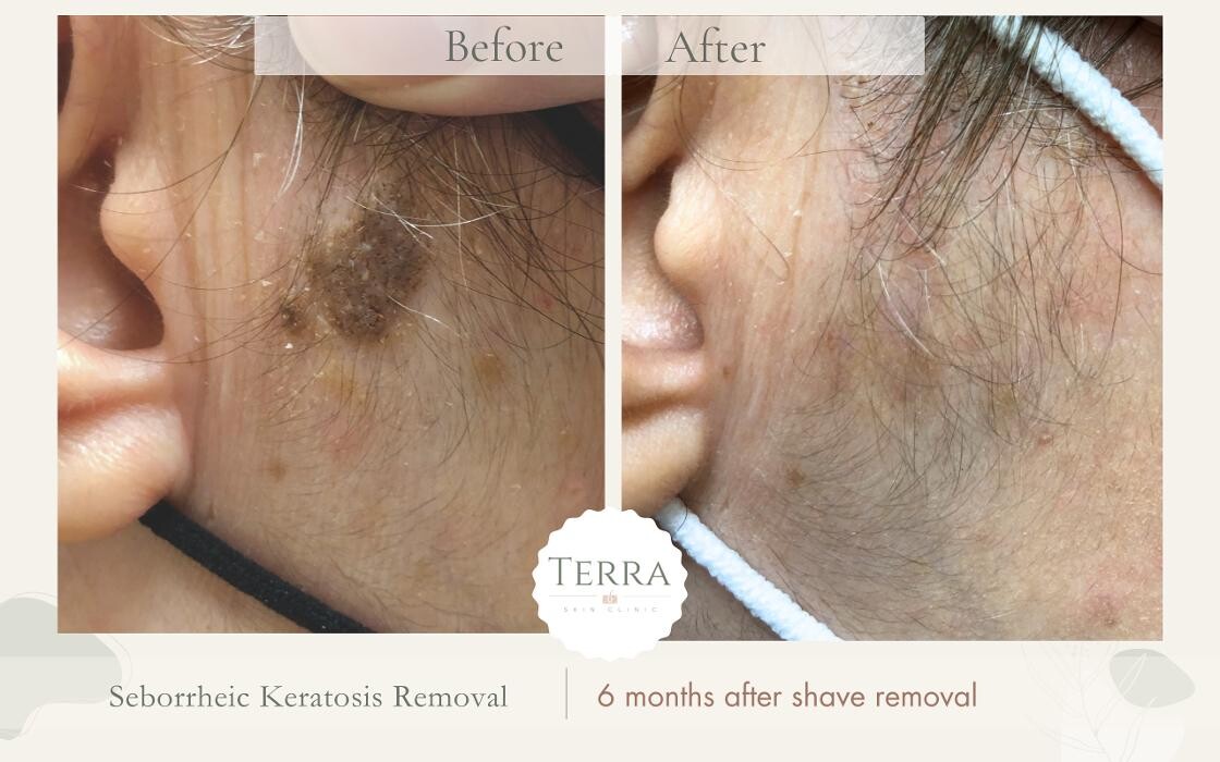 Images Terra Skin Clinic