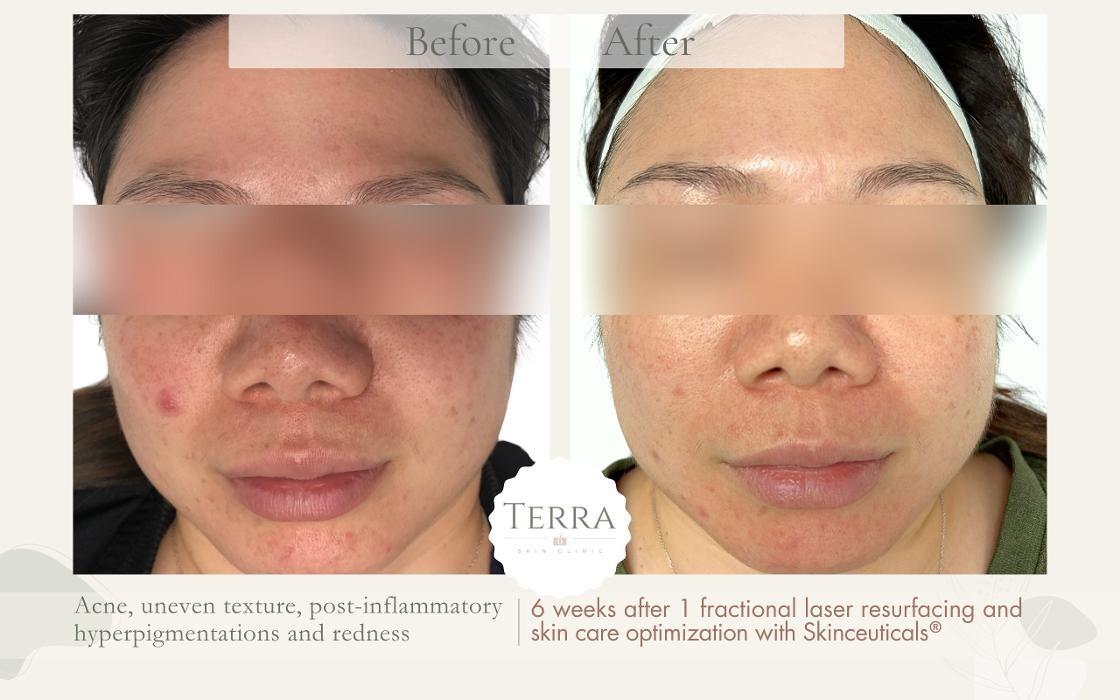 Images Terra Skin Clinic
