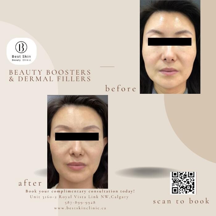 Images Best Skin