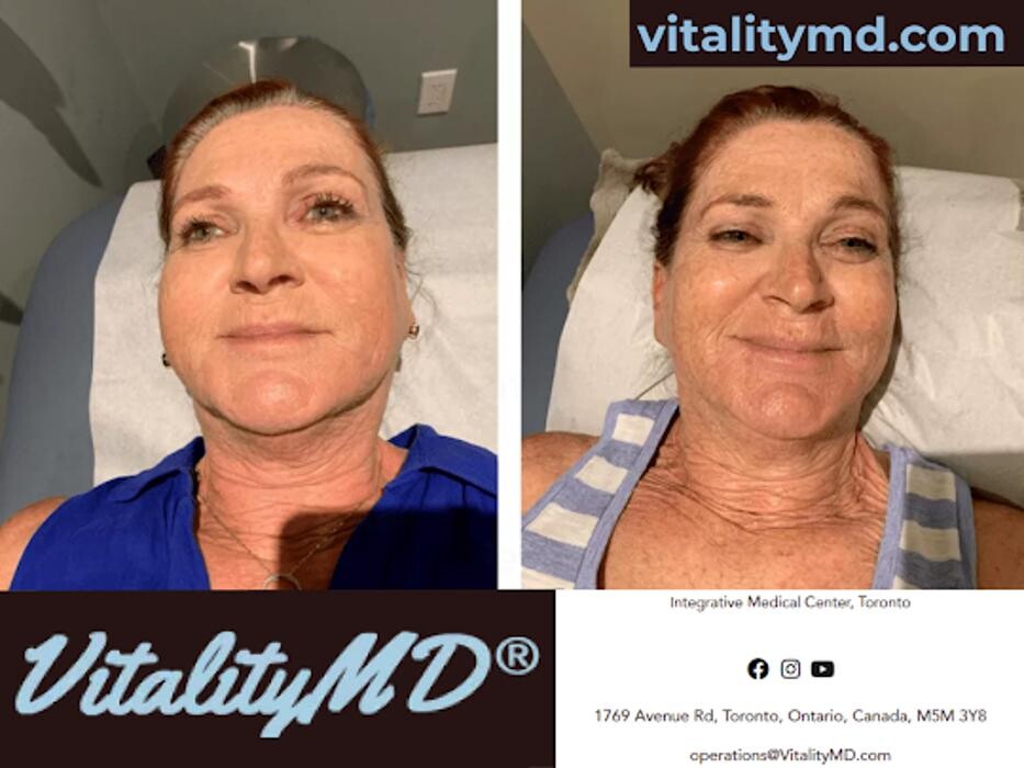 Images VitalityMD Medical Spa Toronto