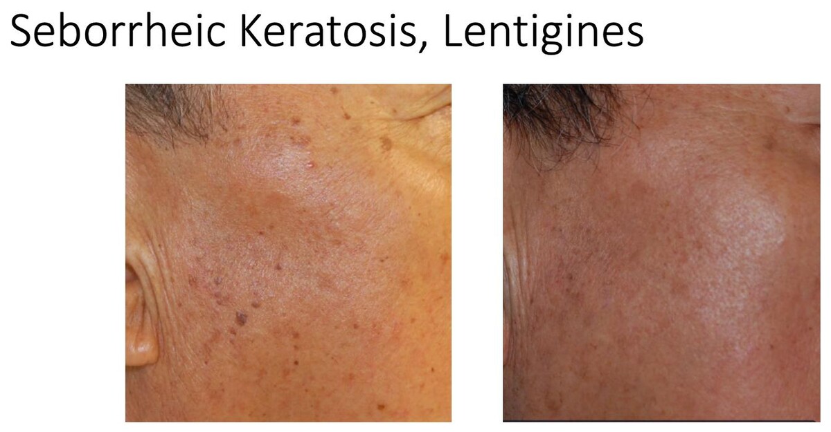 Images Central Oakville Skin Revitalization
