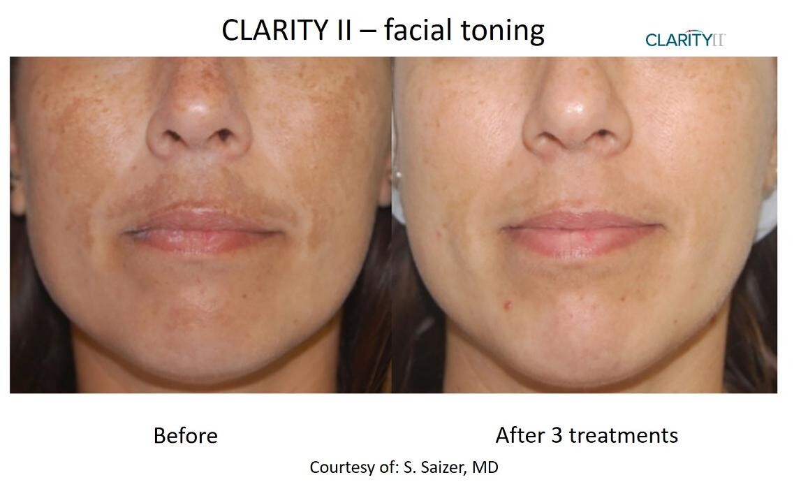 Images Central Oakville Skin Revitalization
