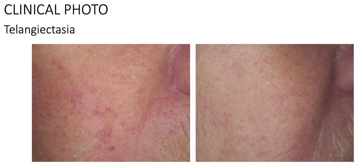 Images Central Oakville Skin Revitalization