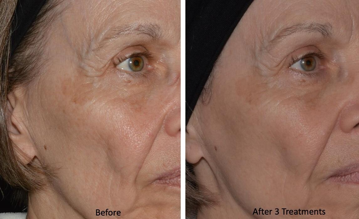 Images Central Oakville Skin Revitalization