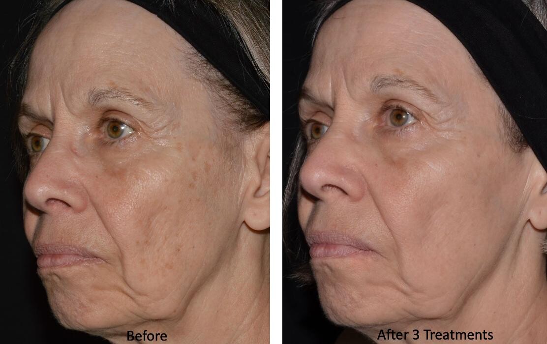 Images Central Oakville Skin Revitalization