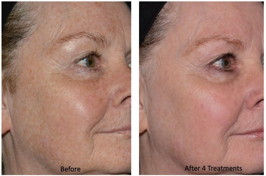 Images Central Oakville Skin Revitalization