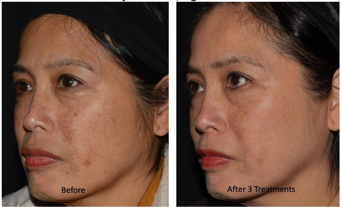 Images Central Oakville Skin Revitalization
