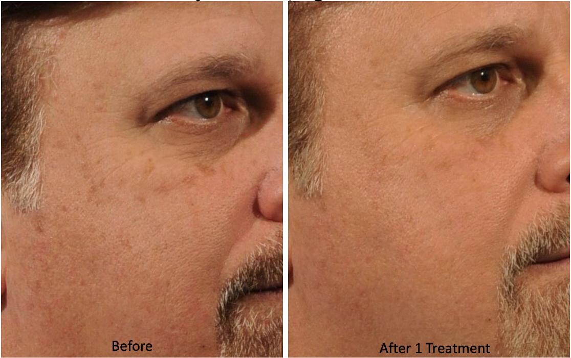 Images Central Oakville Skin Revitalization