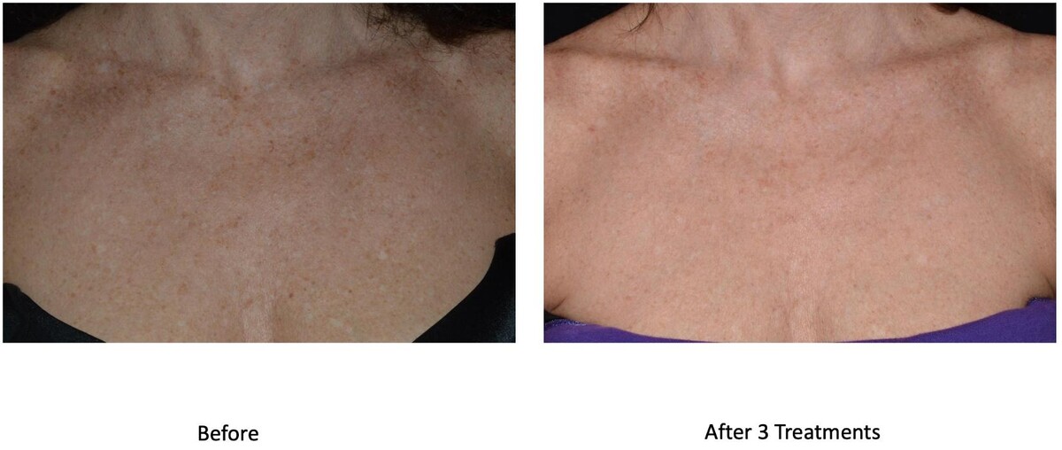 Images Central Oakville Skin Revitalization