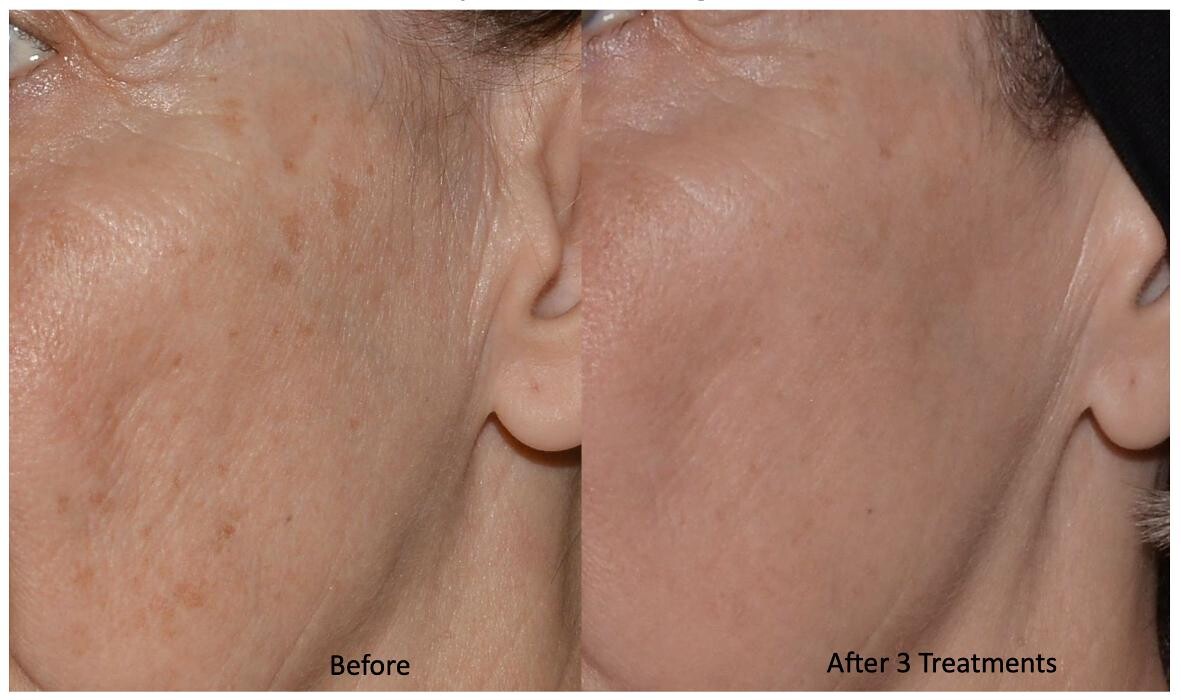 Images Central Oakville Skin Revitalization